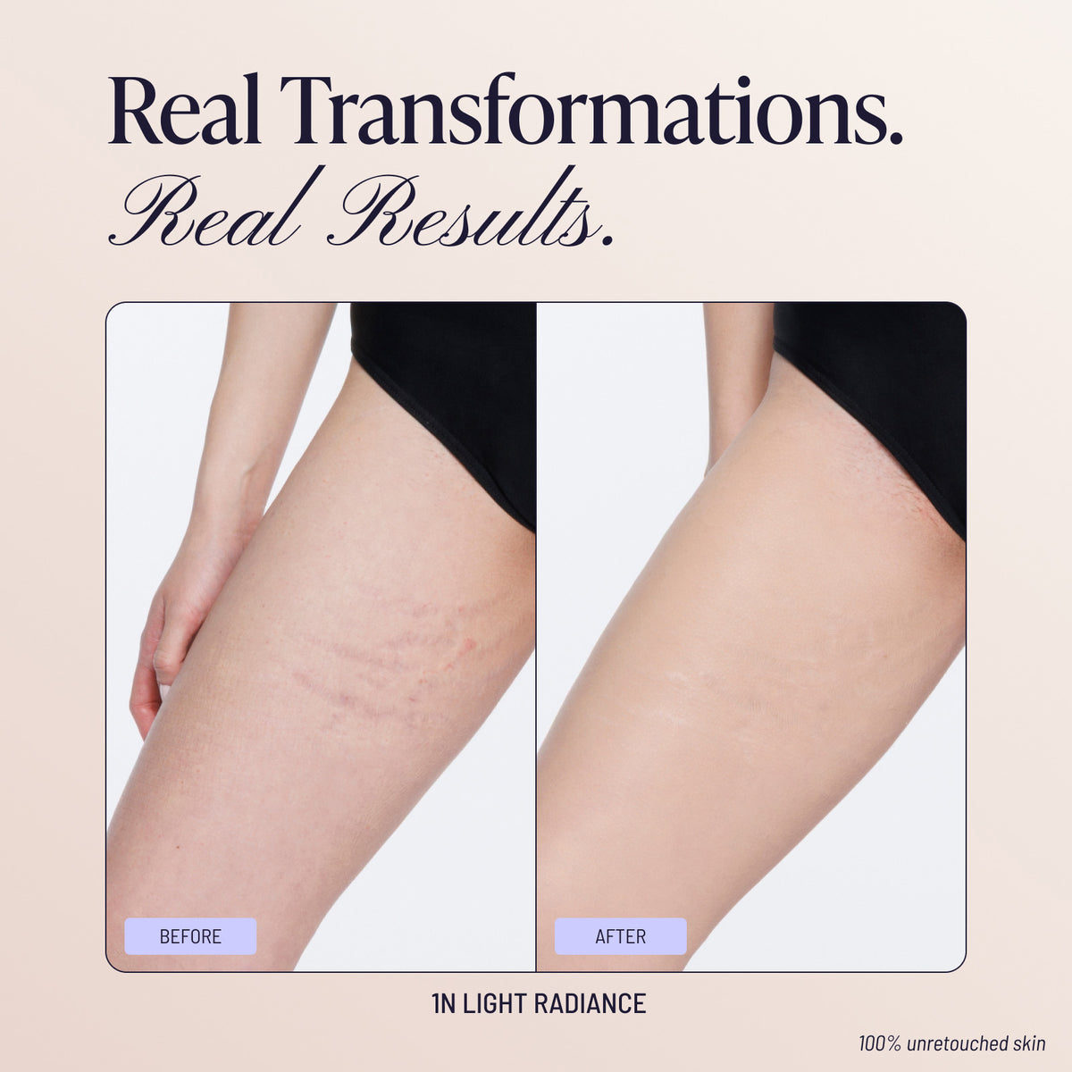 Body Coverage Perfector