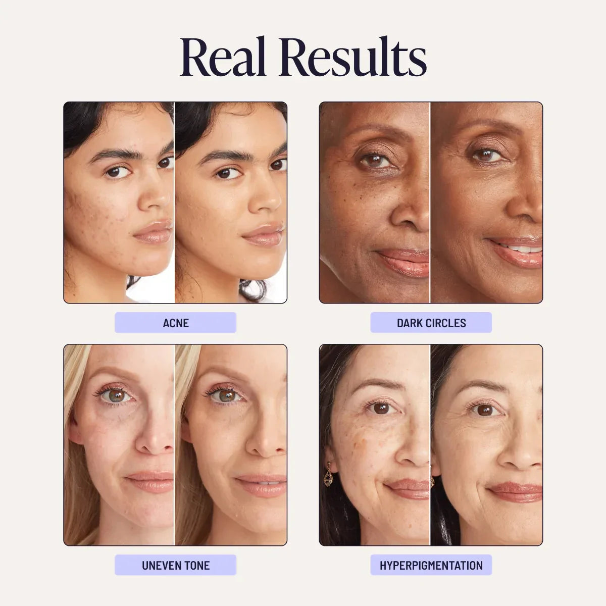 Supreme Creme conceals skin imperfections