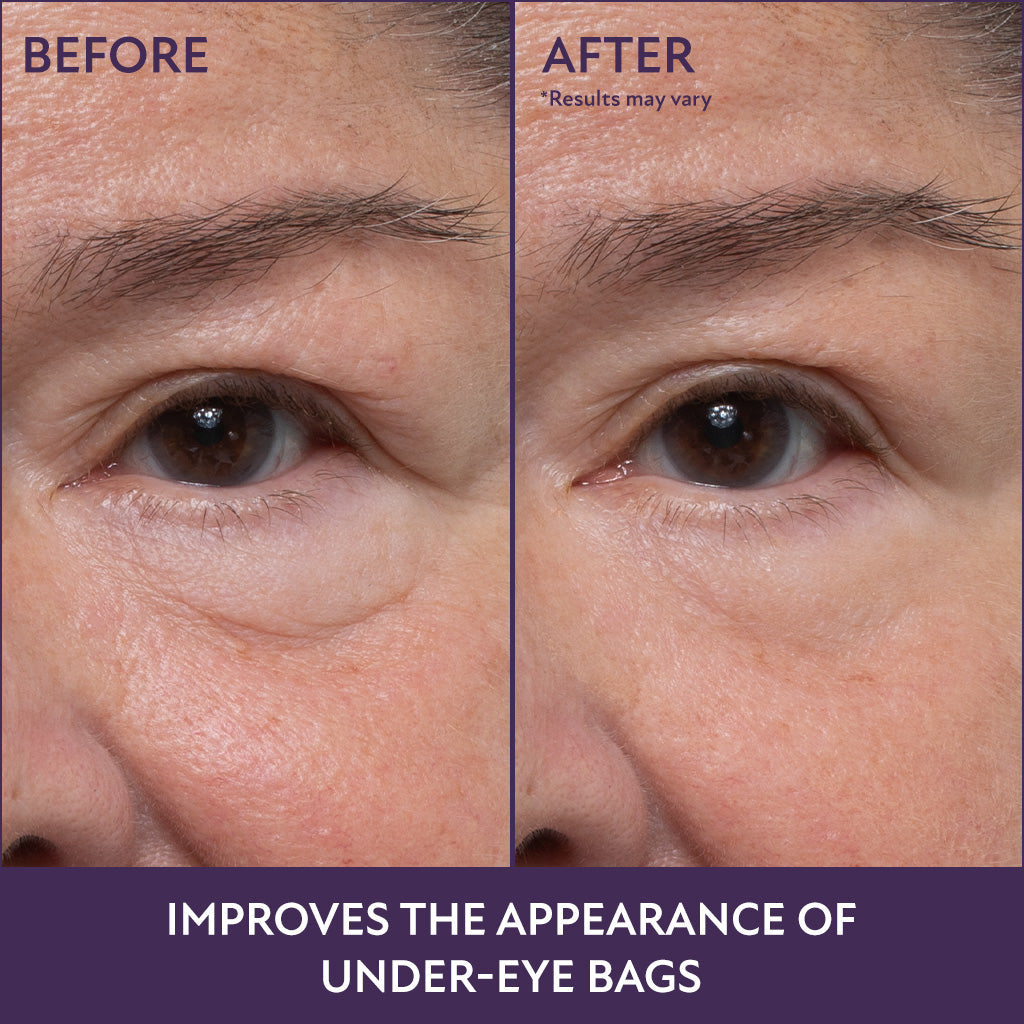 60-Second Eye Effects Gel (3-Pack)